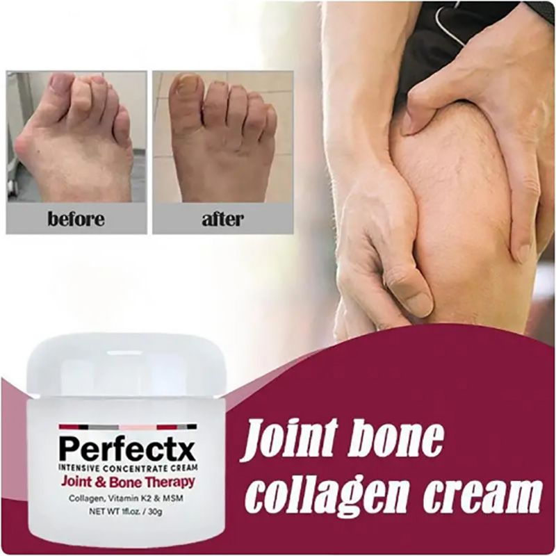 Perfectx Counterpain Cream Joint Bone Pain Relief Cream Orthopedic Valgus Corrector Knee Muscle Arthritis Treatment Ointments