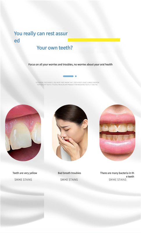 SP-6 Probiotics Whitening and Staining Toothpaste Freshens Breath and Improves Yellow Teeth 120g