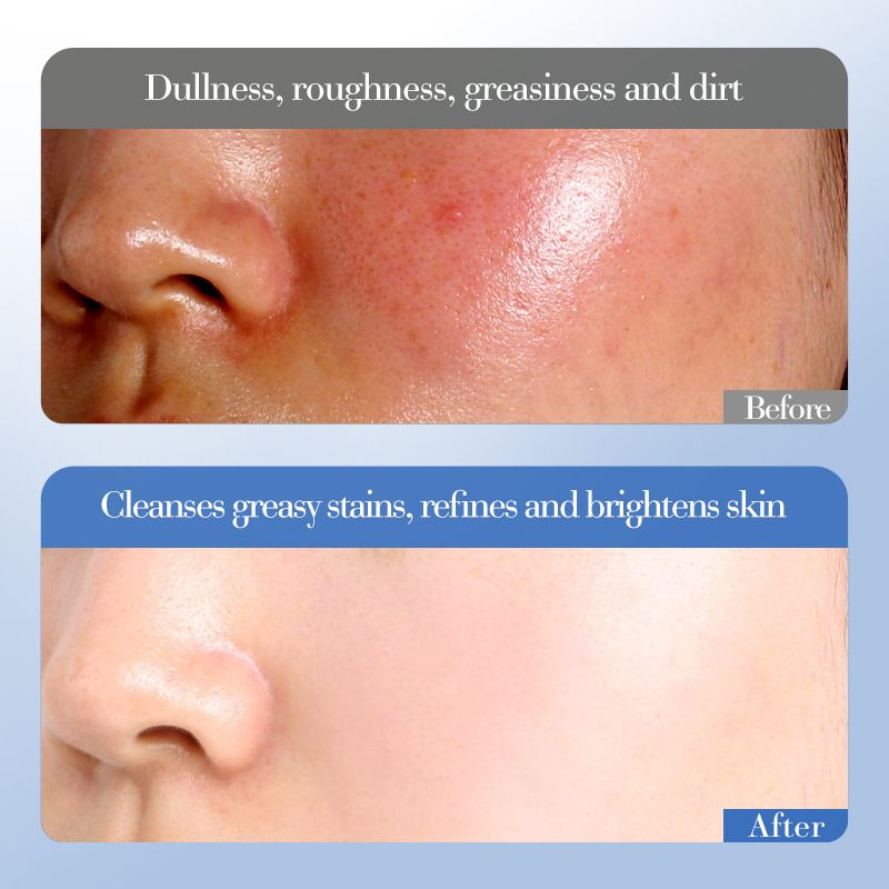 SADOER White Rice Niacinamide Brightening Moisturizing Set Box Moisturizing Skincare Product Set