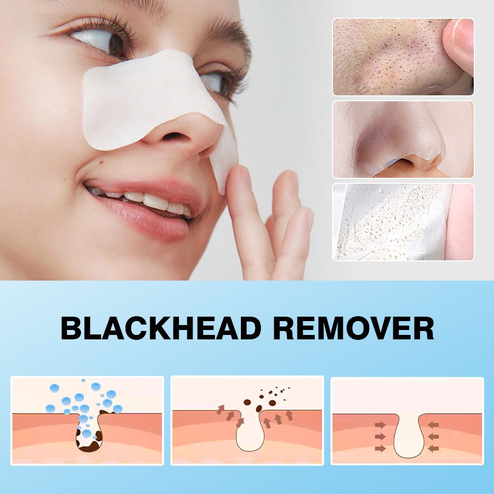 Nose Patch for Blackhead & Acne Removal, Gentle Deep Cleansing Nose Mask to Refine Pores
