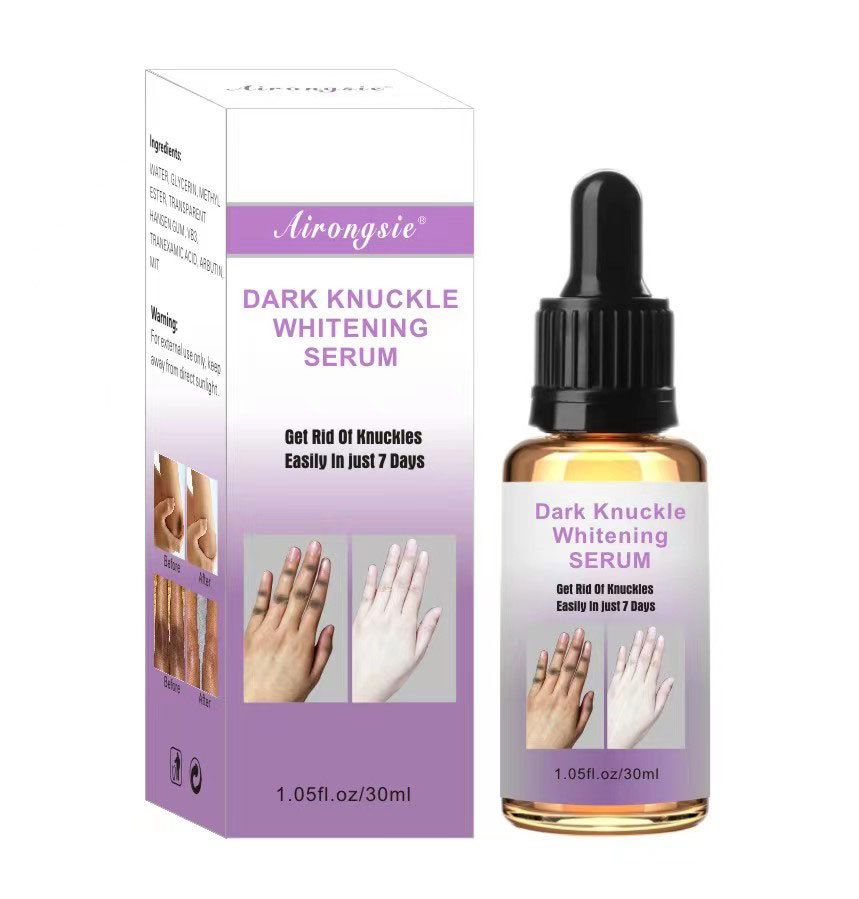Airongsie Dark Knuckle Whitening Serum - Fast-Acting Hyperpigmentation Treatment for Hands, Elbows & Knees - Lighten Dark Spots in 7 Days - 1.05fl oz/30ml - Finger Joints, Elbow & Knee Brightening Serum