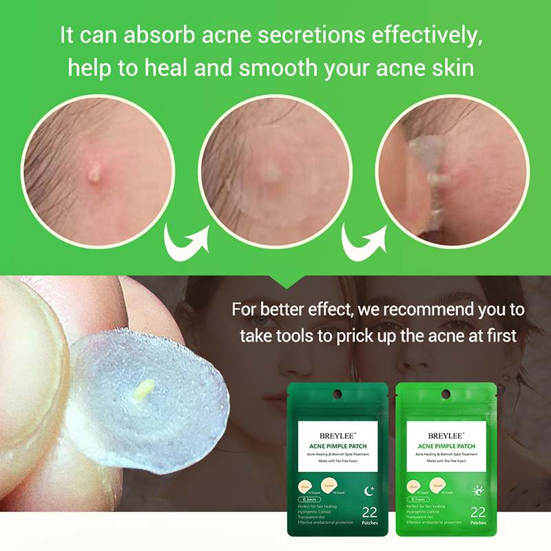 Acne Pimple Patch Stickers Acne Treatment Pimple Remover Tool Blemish Spot Facial Mask Skin Care Waterproof 22 Patches