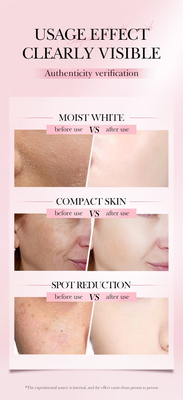 SADOER 4-in-1 facial brightening and highly moisturizing essence Rejuvenating essence