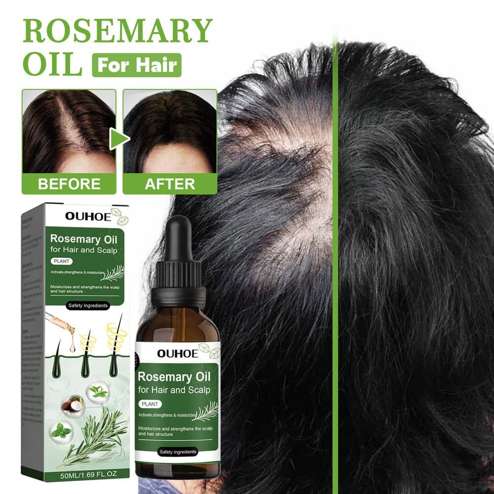 OUHOE Rosemary oil For Hair Growth Product, Growing Hair Essential Oil Beauty Hair Care, Prevent Hair Loss Oil 