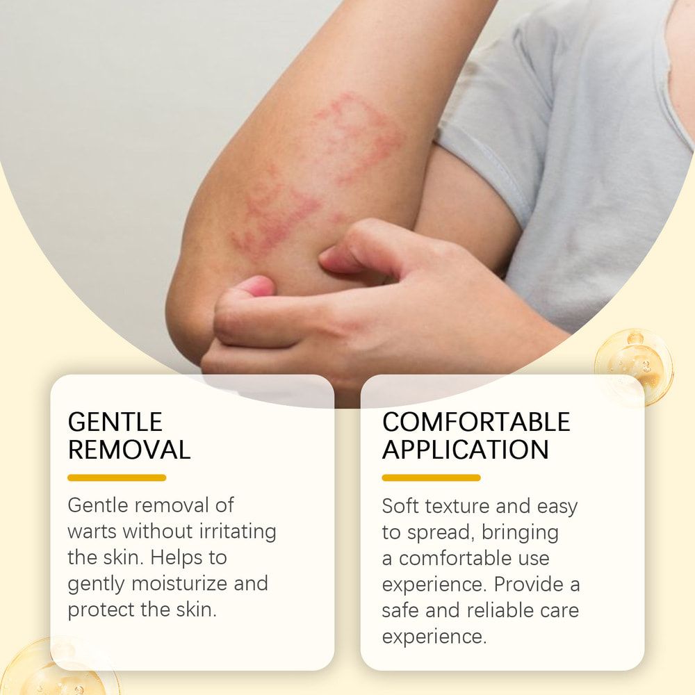 SOUTH MOON Bee Venom Cream Relieves Redness Repair Damage Skin Strengthens Skin Barrier Deep Moisturizing Skin Care Nourishing Body Cream