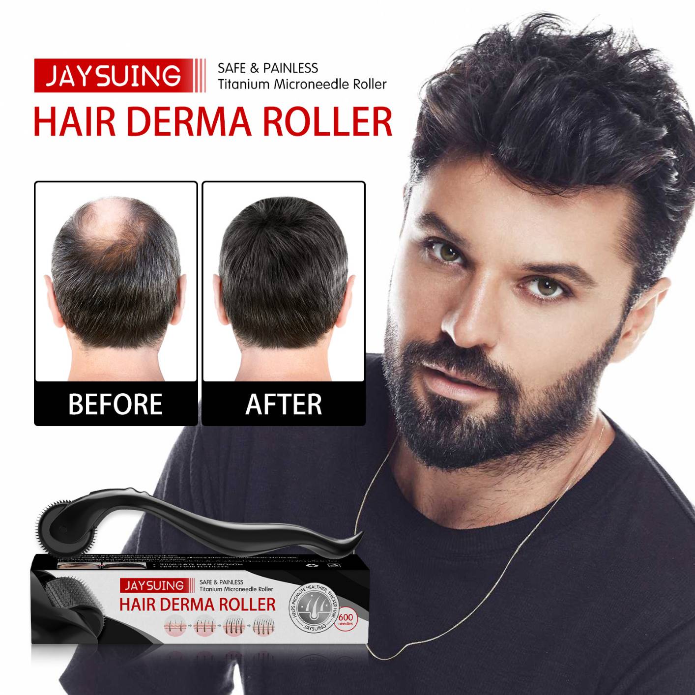 Jaysuing Derma Roller Microneedle Roller for Face Body Beard Hair Growth, 540 Titanium Microneedle Roller for Home Use
