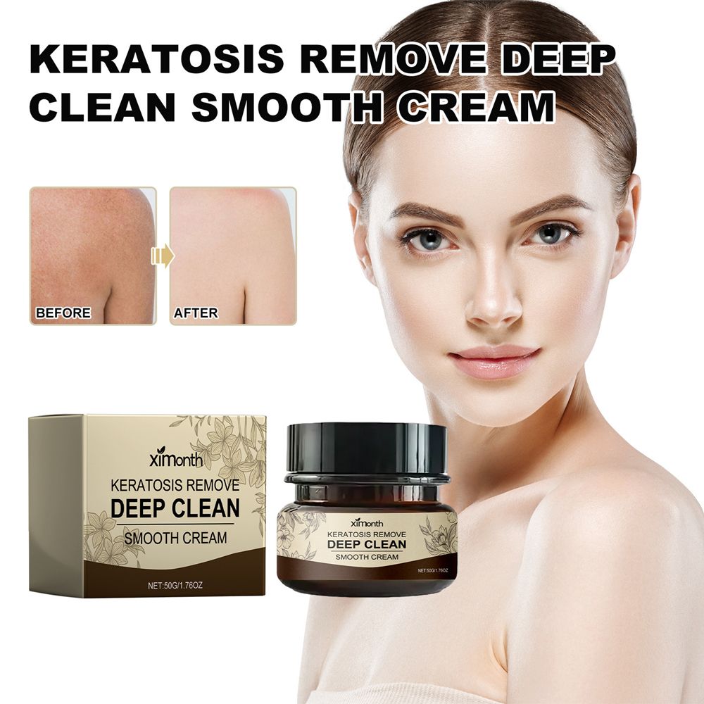 Ximonth Keratosistreat Deep Clean Smooth Cream, Keratosis Treat Deep Clean Smooth Cream, Cleansing Massage Cream, Suitable for Rough and Bumpy Dry Skin