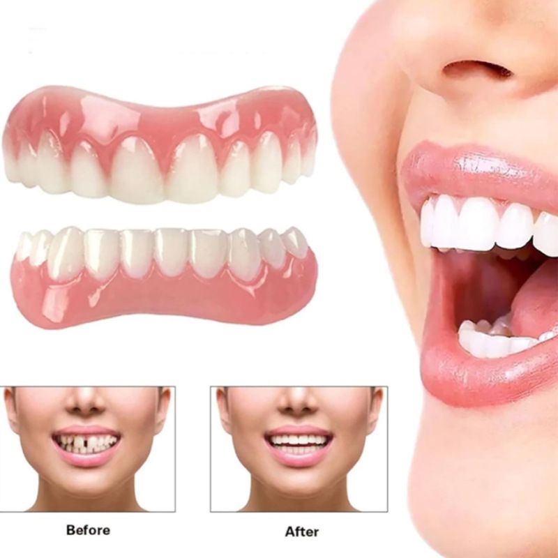 Fourth generation instant smile dentures with silicone simulated teeth, whitening braces, and smiling denturesHeart shaped box with bottom t