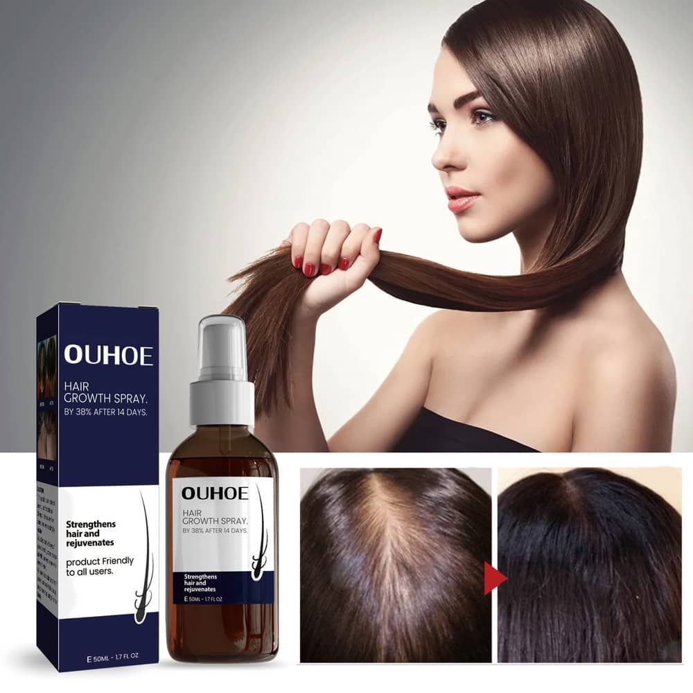 OUHOE Hair Growth Spray Thicker Longer Prevent Baldness Repair Damage Strengthen Nourish Moisturize Scalp Treatment Anti Hair Loss Oil