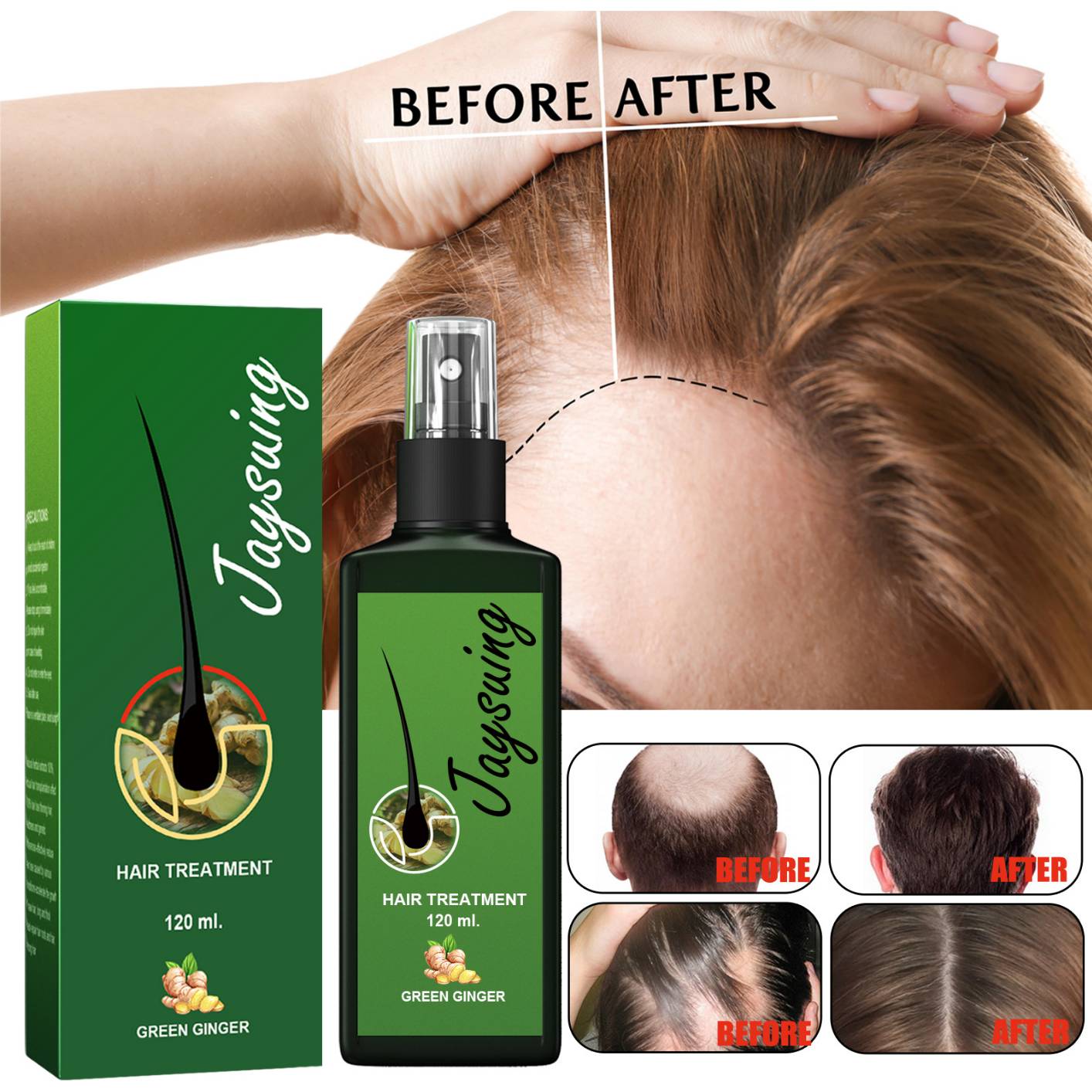 Hair Growth Spray Effective Nourishing Root Hair Thick Growth Liquid Anti-fall Scalp Massage Repair Spray